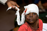 Boy_receiving_treatment_after_Haiti_earthquake